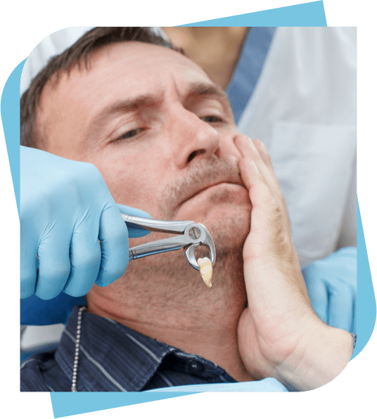 Man holds his cheek after dentist extracts a tooth and shows it to him.